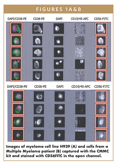 Images of myeloma cell line H929 (A) and cells from a Multiple Myeloma patient (B) captured with the CMMC kit and stained with CD56FITC in the open channel.