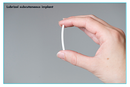 Lubrizol subcutaneous implant