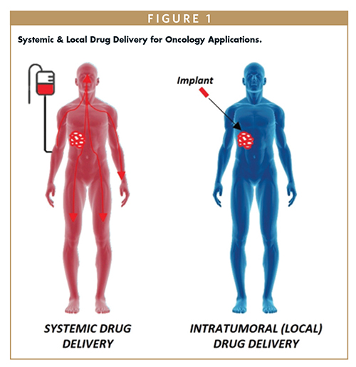 Systemic & Local Drug Delivery for Oncology Applications.