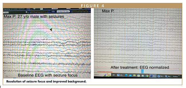 Resolution of seizure focus and improved background.